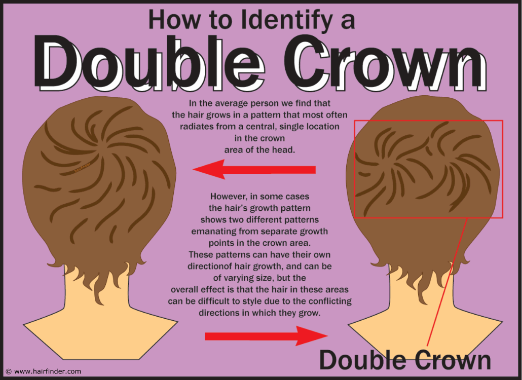 Haircuts For A Double Crown Hair Growth Pattern Haircuts For A Double Crown Hair Growth Pattern