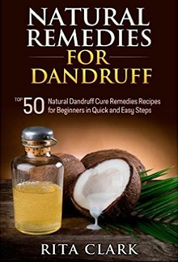 Natural Remedies for Dandruff