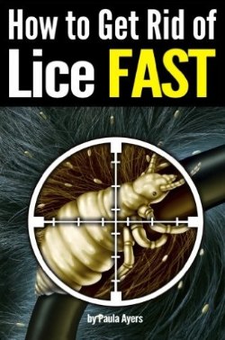 How to Get Rid of Lice Fast
