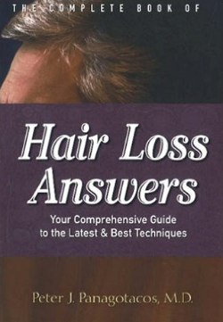 Hair Loss Answers