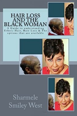 Hair Loss and the Black Woman