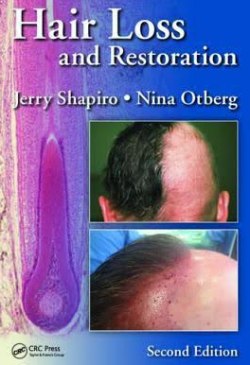 Hair Loss and Restoration