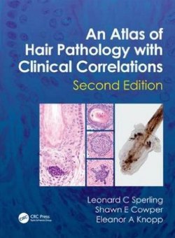 Atlas of Hair Pathology