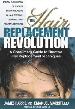 The Hair Replacement Revolution