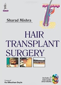 Hair Transplant Surgery