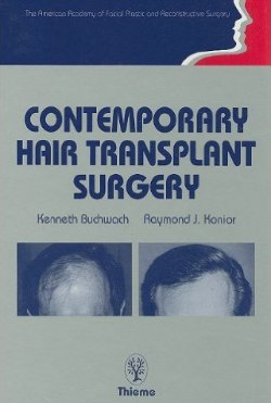 Contemporary Hair Transplant Surgery