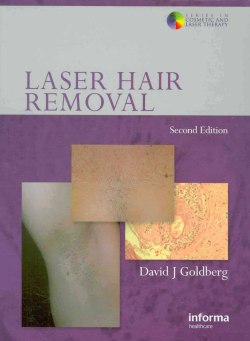 Laser Hair Removal