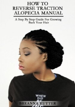 How To Reverse Traction Alopecia Manual