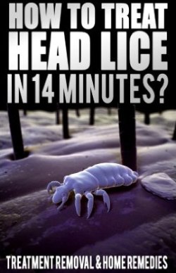 How To Treat Head Lice