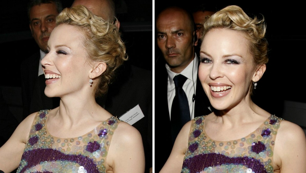 Kylie Minogue's plastic surgery transformation over the years