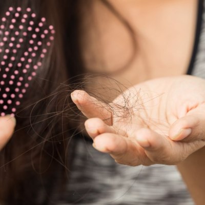 Haarausfall bei Frauen