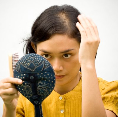 Frau mit Haarausfall