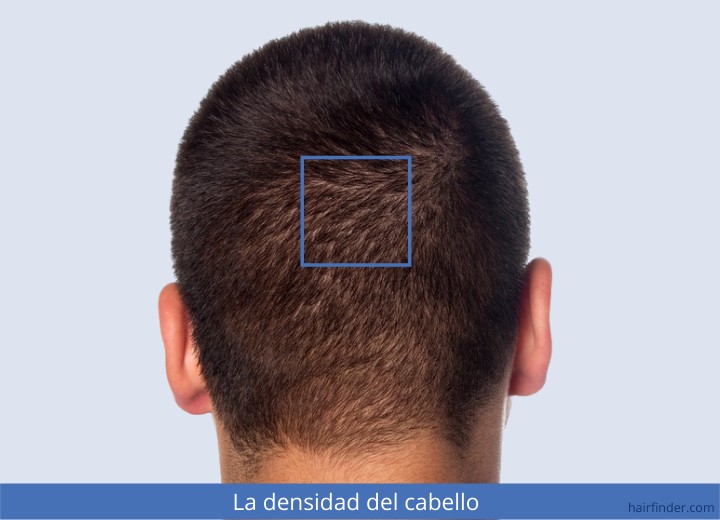 La densidad del cabello