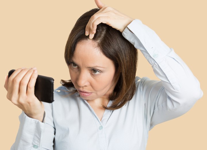 Woman with pattern hair loss