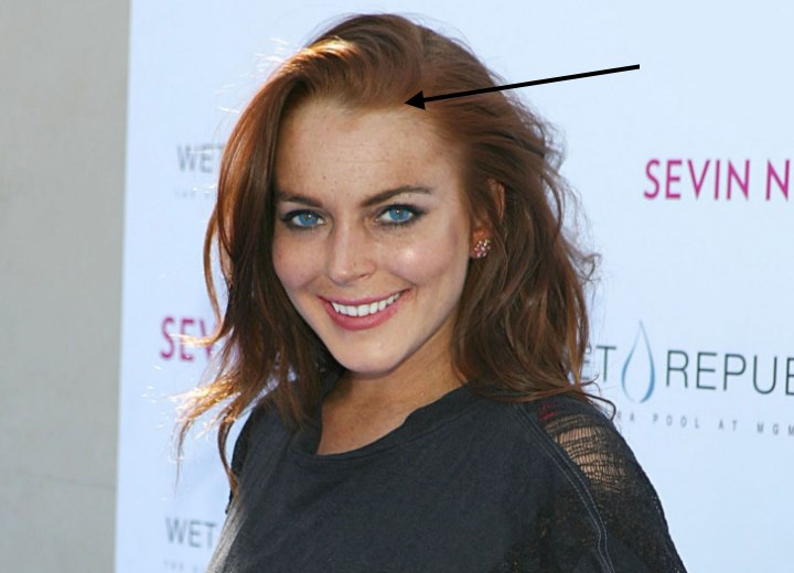 Lindsay Lohan's cowlick