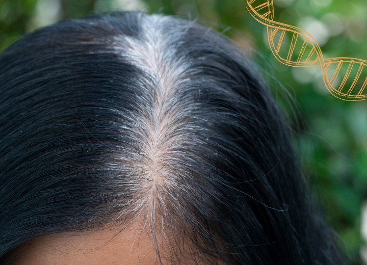 Graying hair, determined by genetic factors