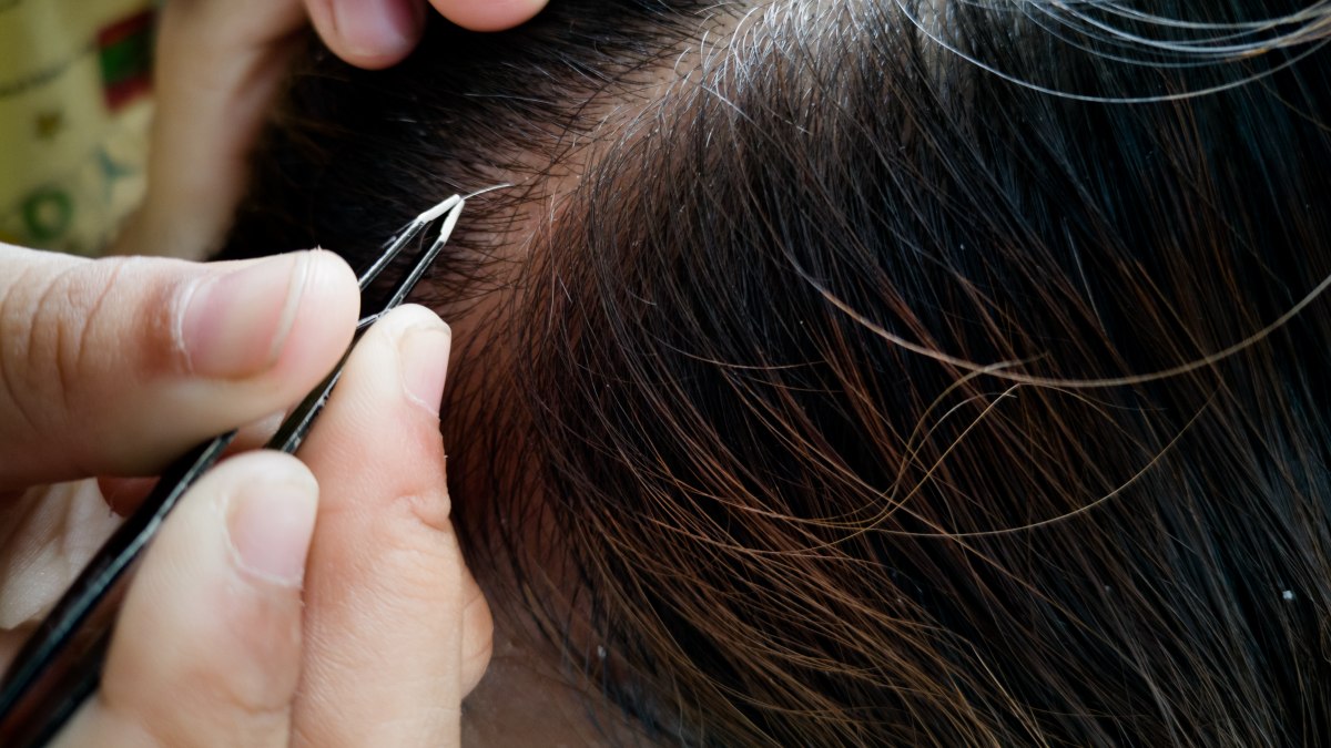 If I remove some white hairs using tweezers, would these white hairs  re-grow again?