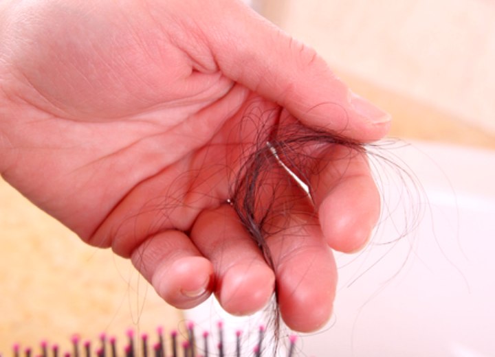 Hand with lost hairs