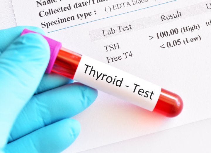 Thyroid test