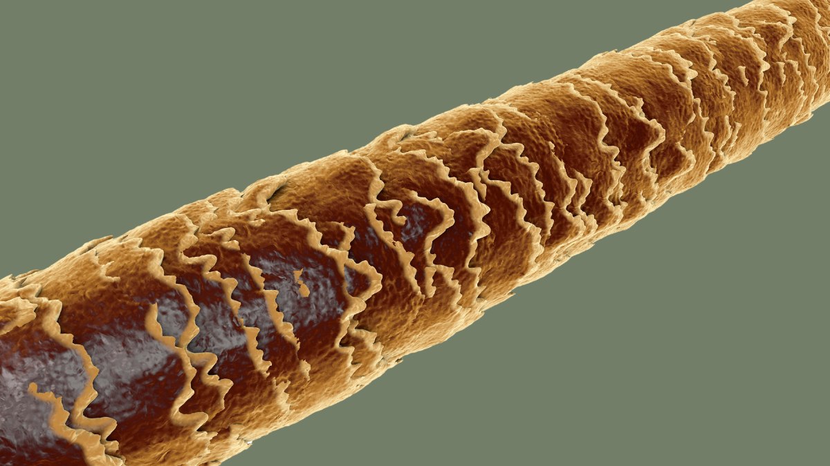 7. The Role of Methyl Blue in Microscopic Examination of Hair Damage - wide 7