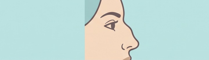 Crooked nose