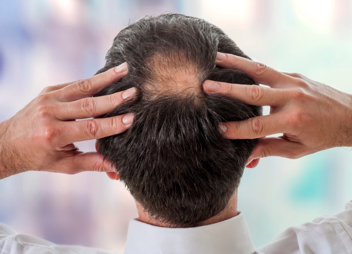 Man with a bald spot on the back of his head