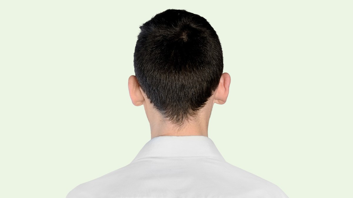 See the scalp under the hair when your hair is very short