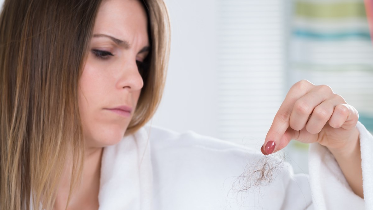hair loss hair loss