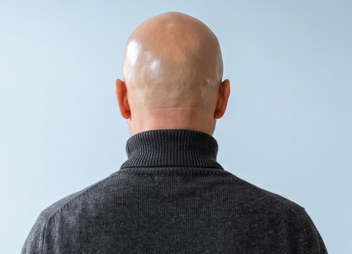 Man with a shiny, bald head
