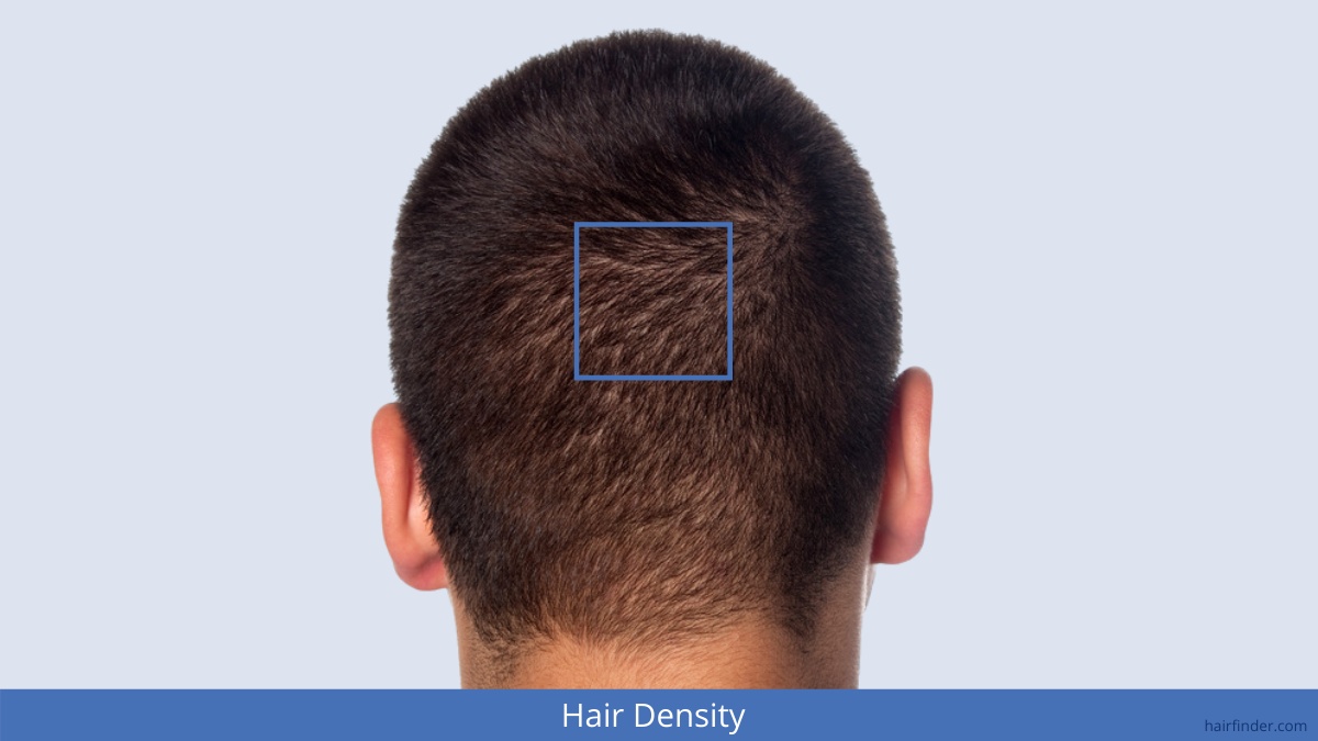 Hair Density | How is hair density mesured?