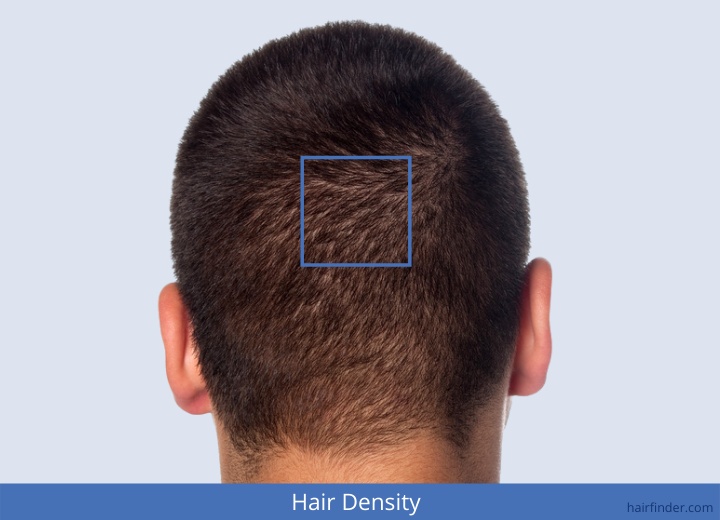 Hair density