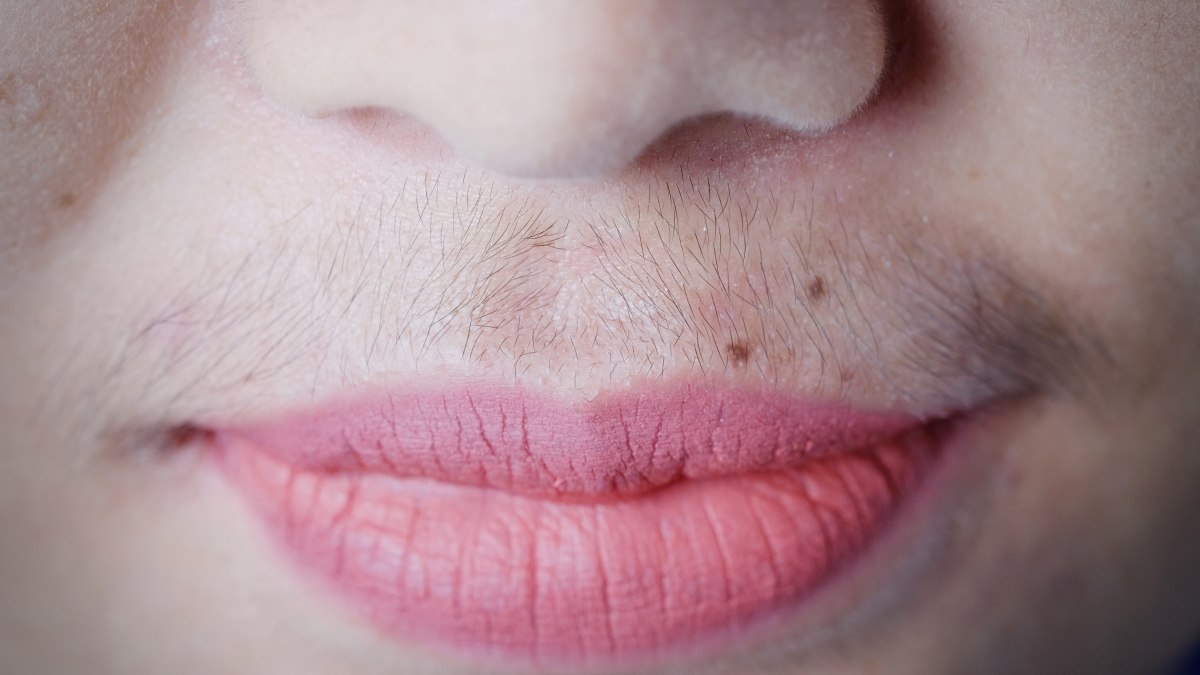 Girl with a moustache or small vellus hairs under her nose