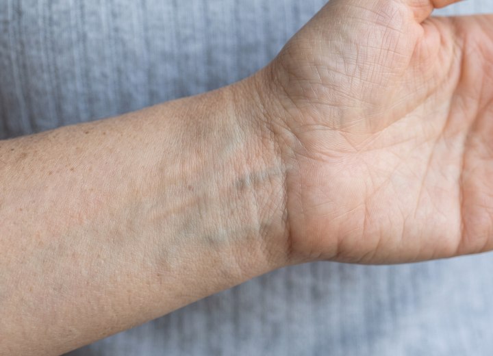Vein test to find you skin's undertone