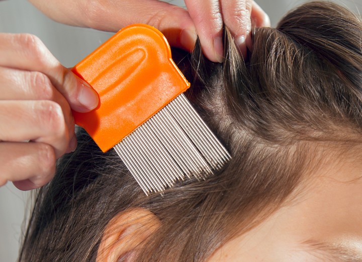 Head lice removal with a head lice comb