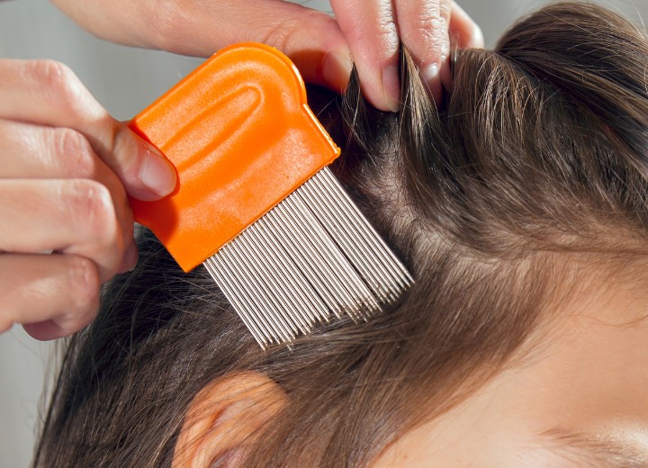 Head lice treatments | Solutions to rid hair of lice and nits