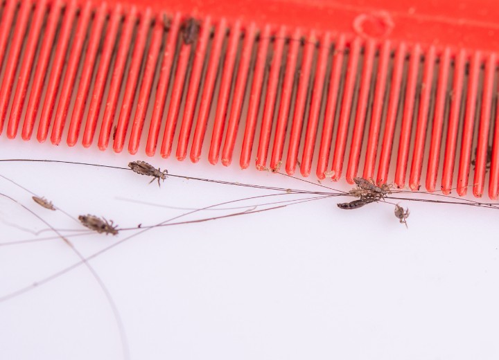 Head lice