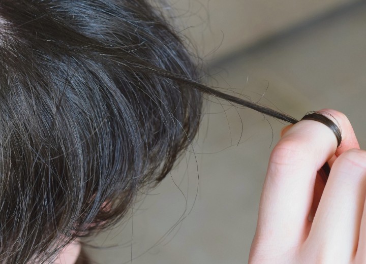 Trich, trichotillomania or compulsive hair pulling