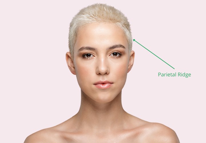 Where the parietal ridge of the head is