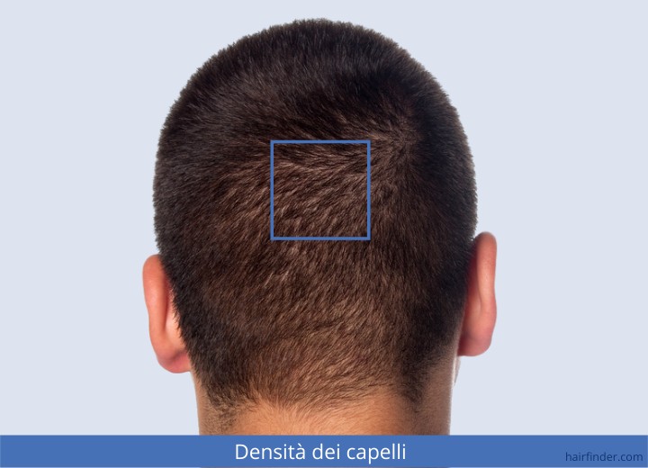 Densità dei capelli