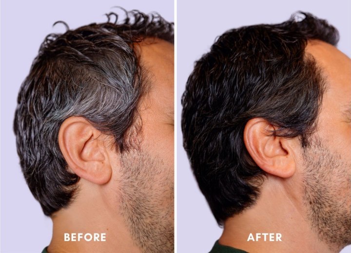 Gray hair coverage for men