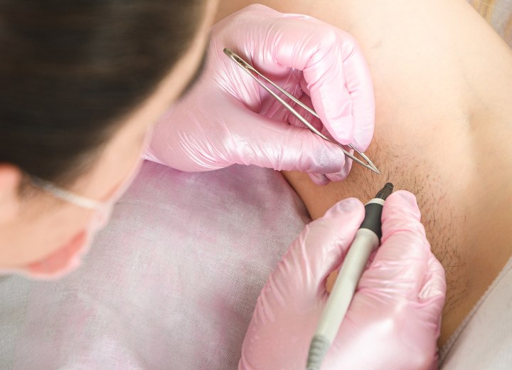 Electrolysis hair removal