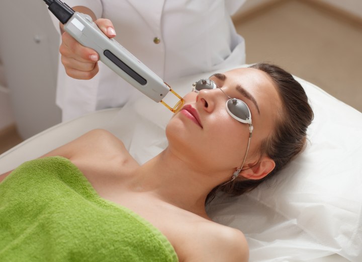 Laser hair removal