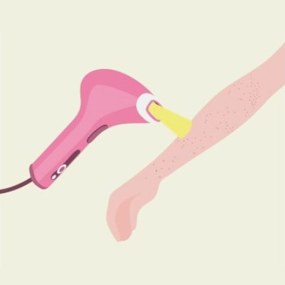 Flashlamp hair removal