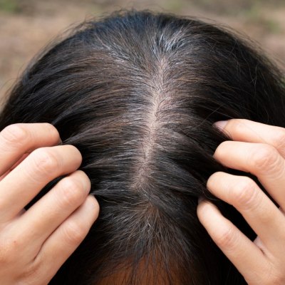 Hair with gray roots