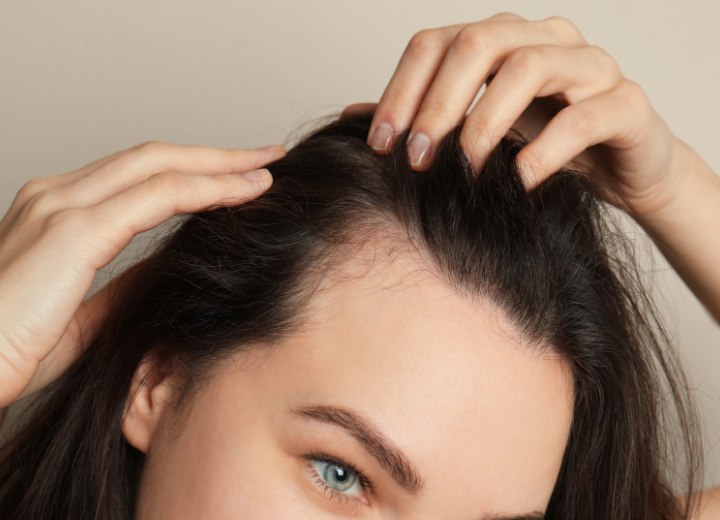Woman who is suffering from hair loss